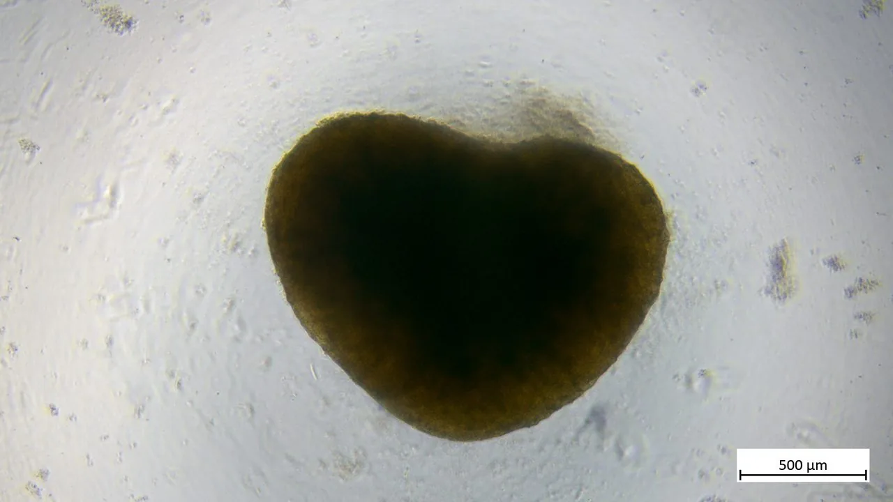 Brightfield image of a mature human iPSC-derived blood vessel organoid with a 500 micrometre scale bar