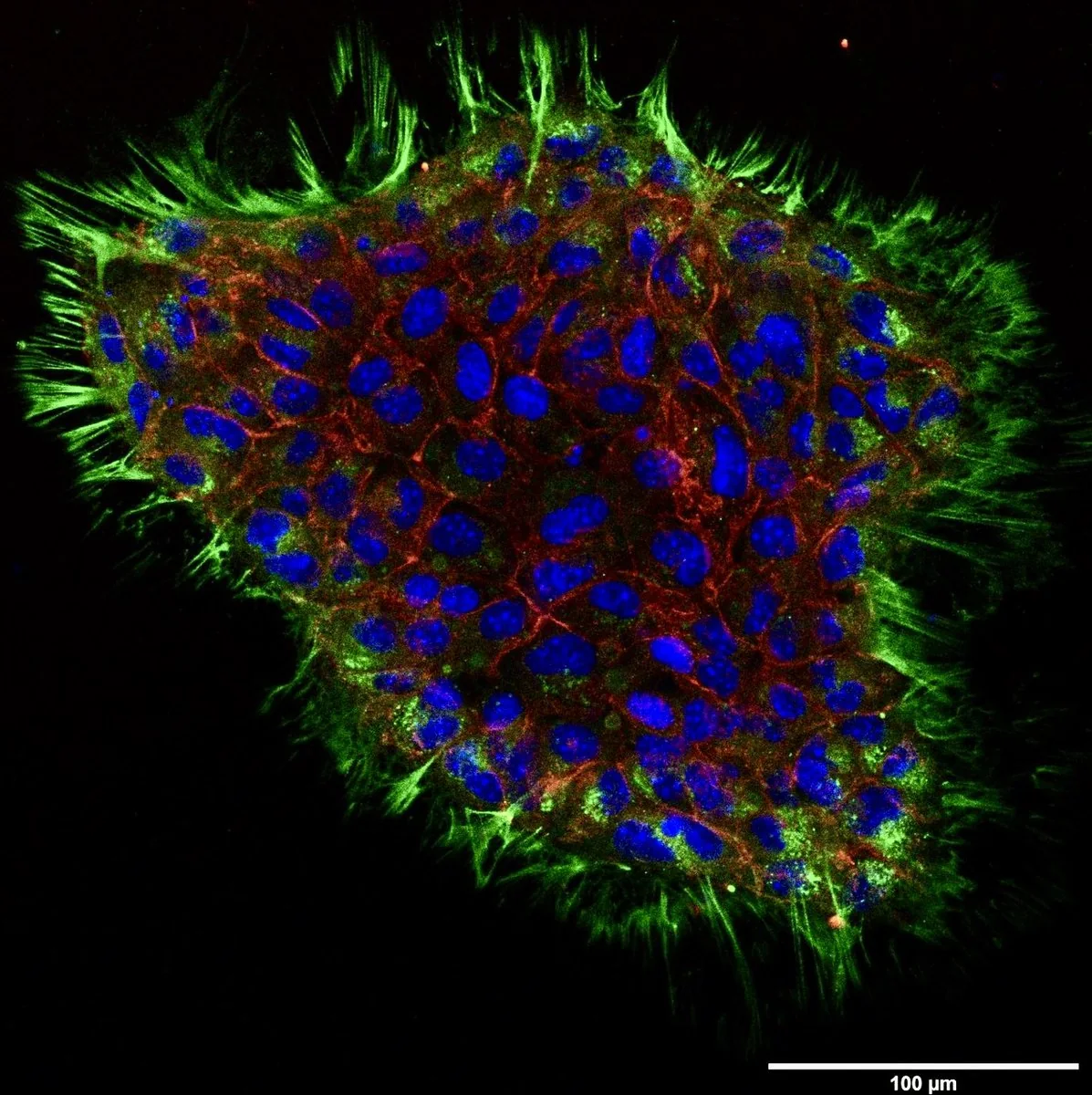 Confocal immunofluorescence of an intestinal TKA organoid