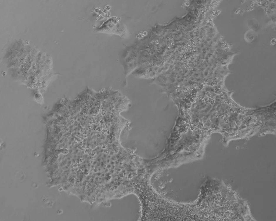 TGF-beta1-treated TKA organoid, flattened and spreading