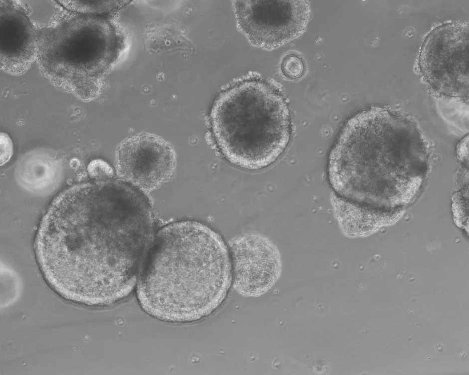 Untreated TKA intestinal organoid, round and compact